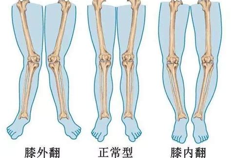 走路外八個性|走路姿势外八的人基本（绝大多数，几乎所有）外向，内八的人基。